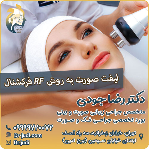 لیفت صورت به روش RF فرکشنال