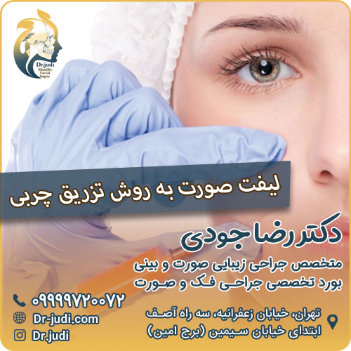 لیفت صورت به روش تزریق چربی