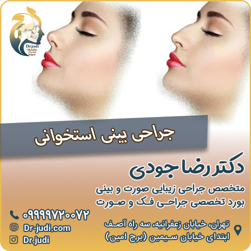 جراحی بینی استخوانی