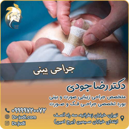 جراحی زیبایی بینی