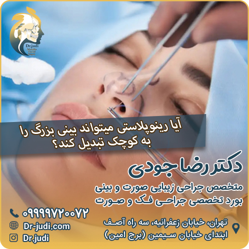 آیا رینوپلاستی میتواند بینی بزرگ را به کوچک تبدیل کند؟
