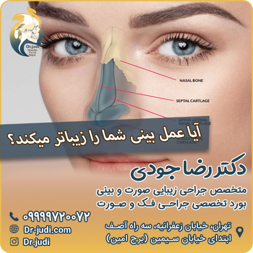 آیا عمل بینی شما را زیباتر میکند؟