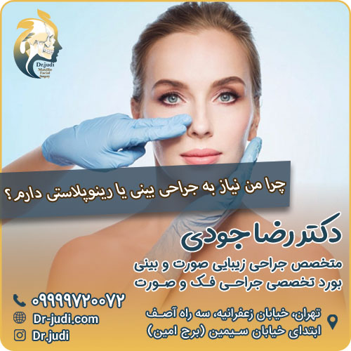 نیاز به جراحی بینی یا رینوپلاستی در افراد