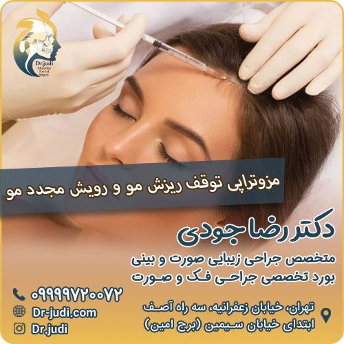 مزوتراپی جهت کمک به توقف ریزش مو و رویش مجدد مو مزوتراپی جهت کمک به توقف ریزش مو و رویش مجدد مو