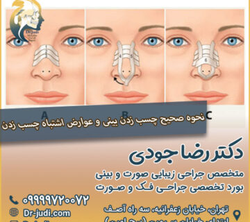 نحوه صحیح چسب زدن بینی و عوارض اشتباه چسب زدن