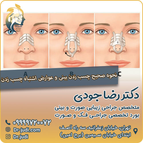 نحوه صحیح چسب زدن بینی و عوارض اشتباه چسب زدن