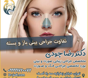 تفاوت جراحی بینی باز و بسته