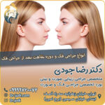 انواع جراحی فک و دوره نقاهت بعد از جراحی فک