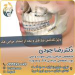 دلیل گذاشتن تراز قبل و بعد از انجام جراحی فک