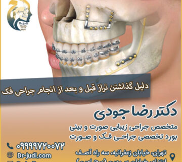 دلیل گذاشتن تراز قبل و بعد از انجام جراحی فک